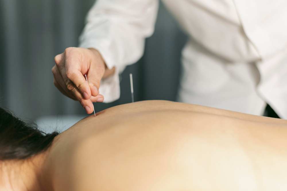 curso acupuntura home